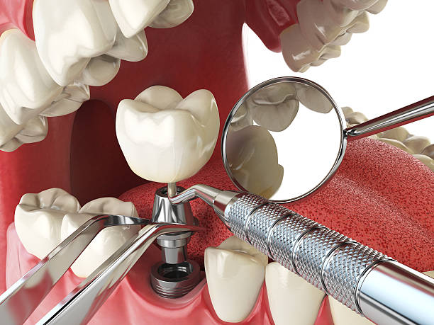 Best Weekend Emergency Dentist in Lisbon, IA